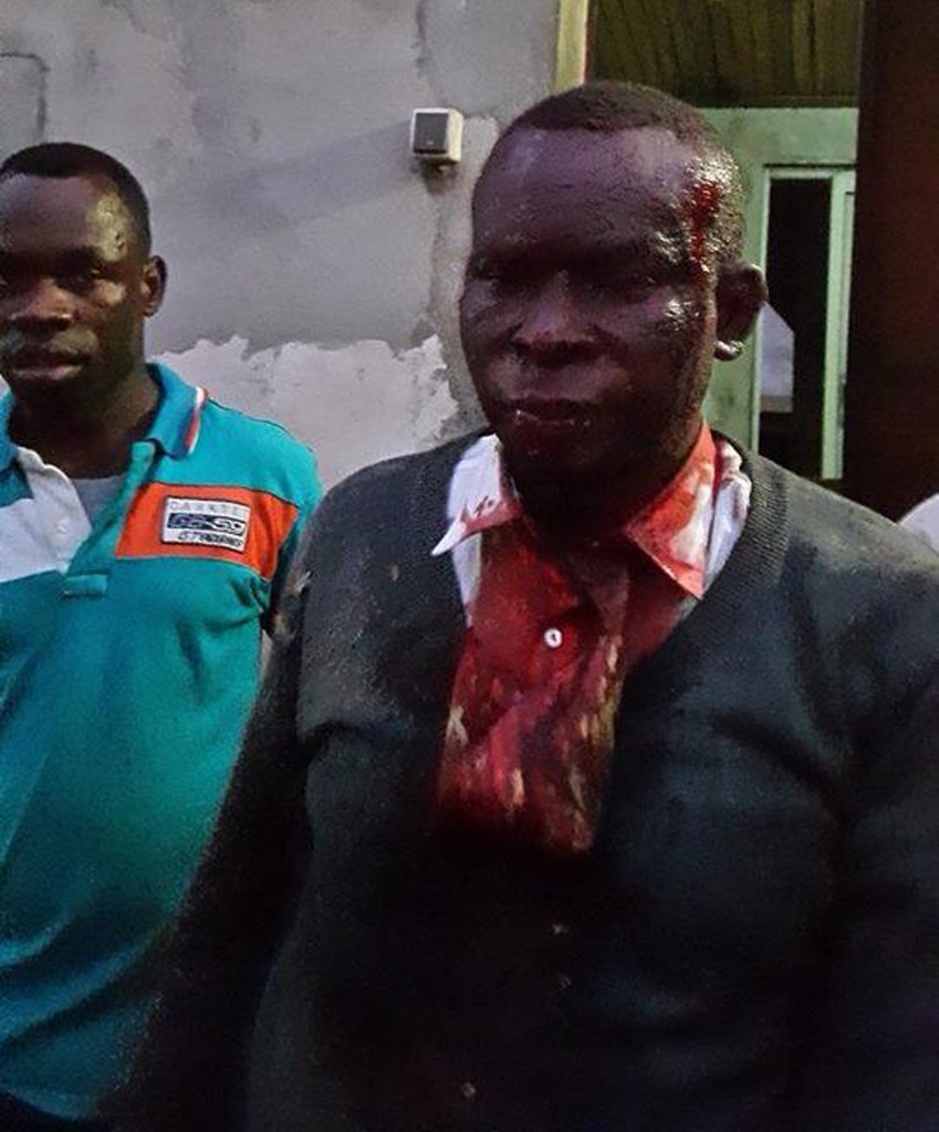 Congolais-blesses